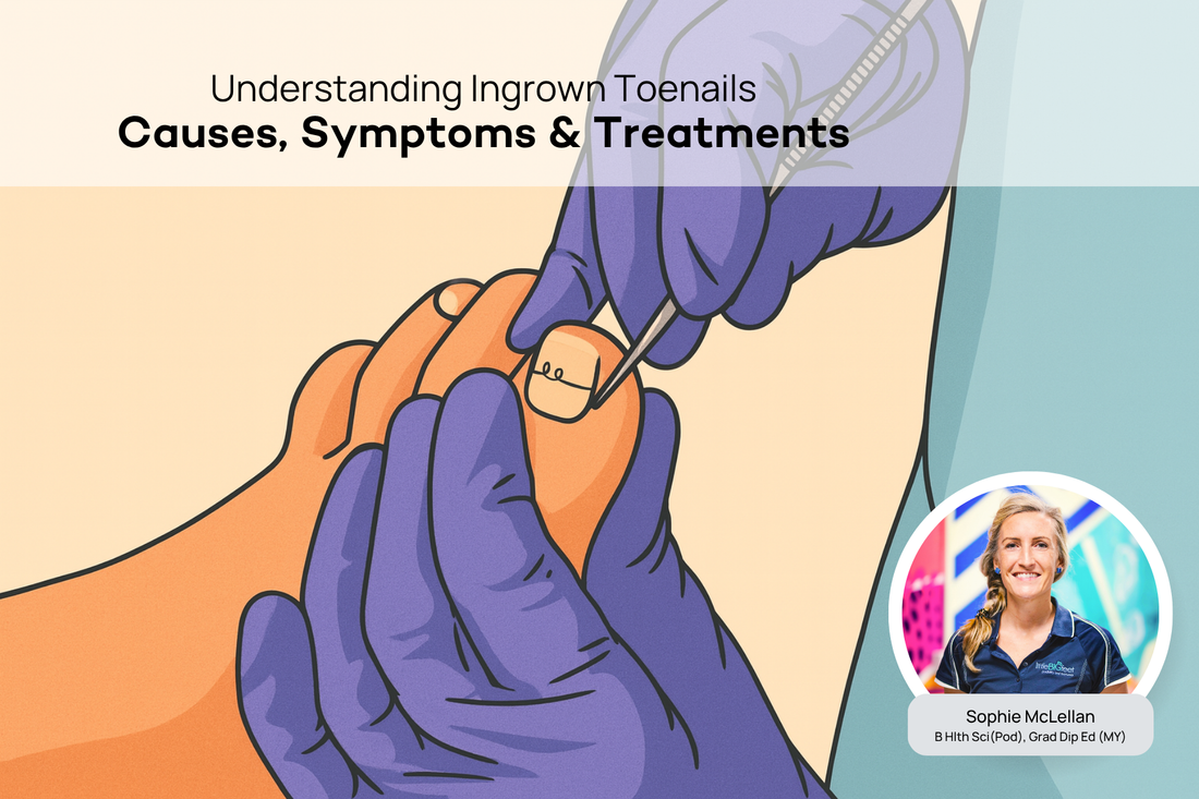 What Are Ingrown Toenails? A Podiatrist Explains the Causes and Treatment